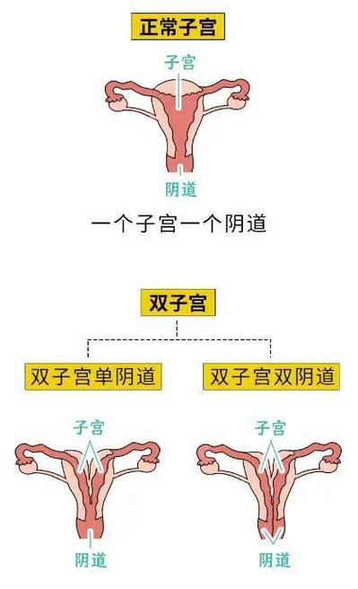 双子宫会来两次月经吗