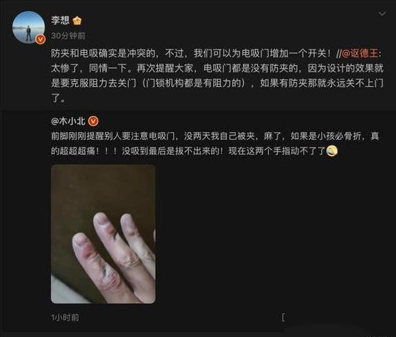 冻伤的黑色印子怎么去除