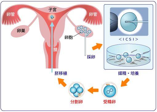 移植鲜胚后喝什么牛奶