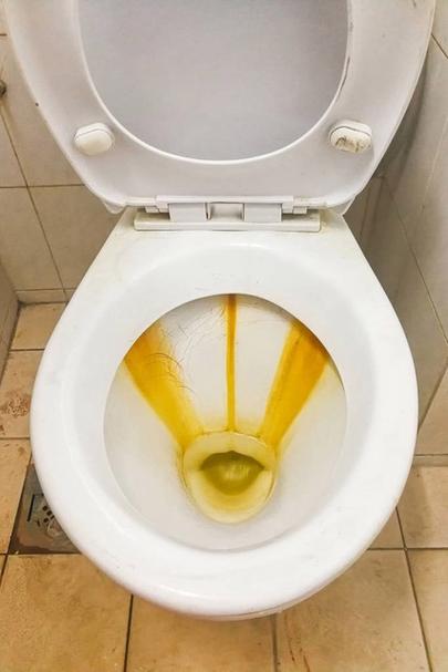 坐便器发黄用什么东西洗掉