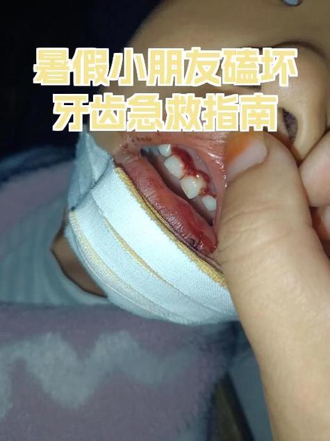 牙齿磕掉了一小块怎么办