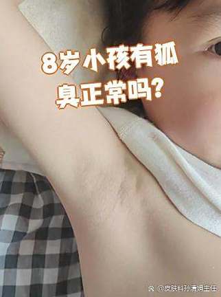 女生有狐臭正常吗