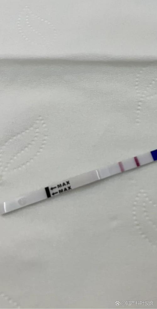怀孕10天最明显的征兆