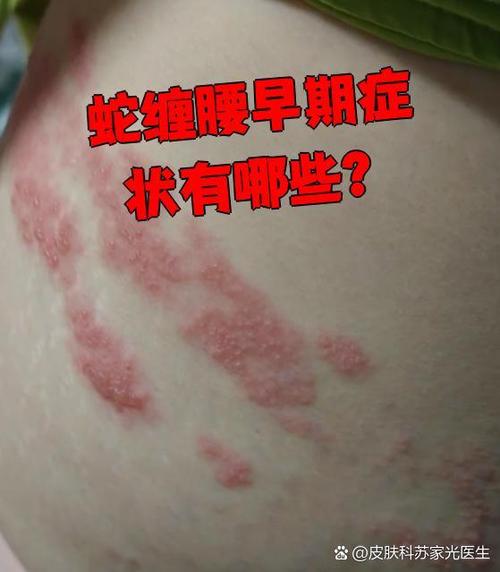 蟒蛇缠腰女孩乳房活命吗缩略图
