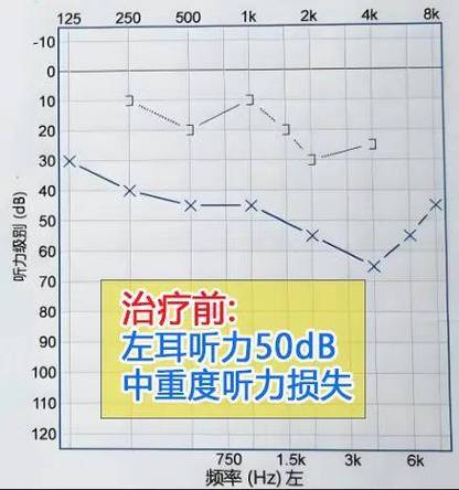 右耳突然感觉没有知觉