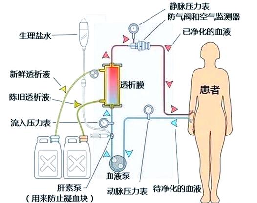 血透原理