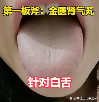 网上中医靠看舌头开药可信吗图标