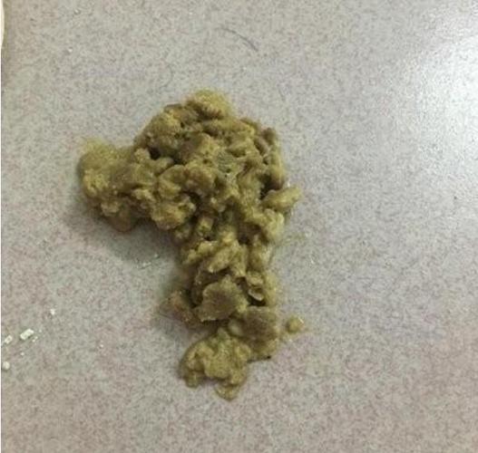 猫胃里有毛球怎么排出