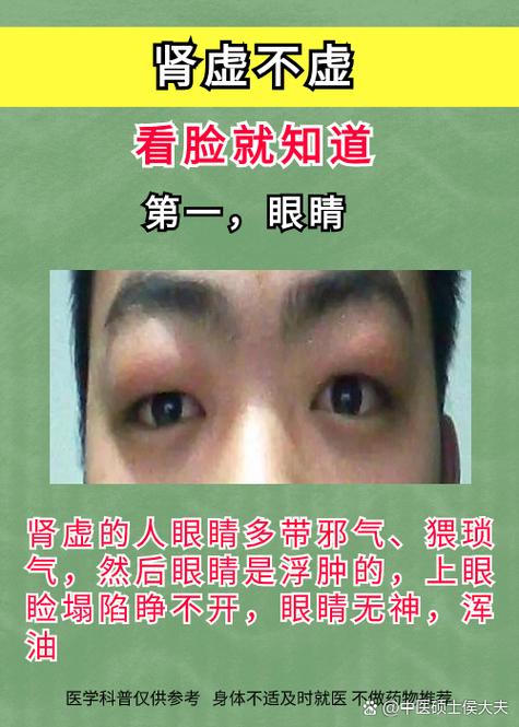 怎么判断自己是否肾虚游戏截图
