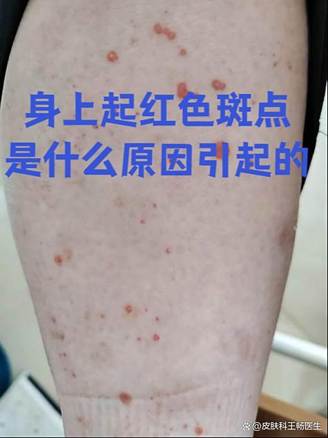 皮肤有红点是怎么回事缩略图