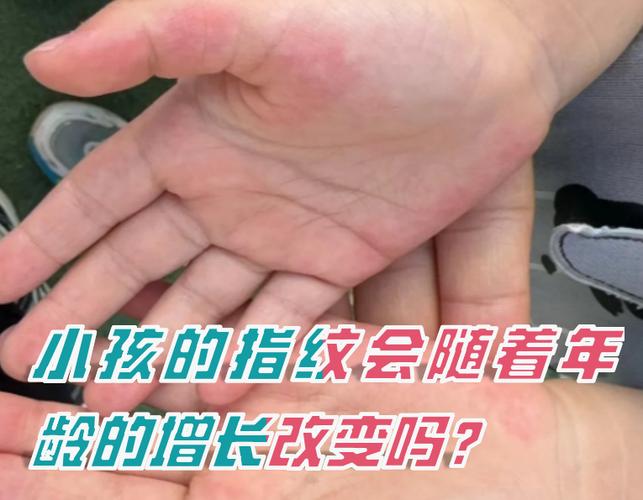 指纹会留在皮肤上吗