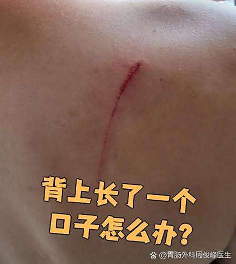 剌口子还是拉口子