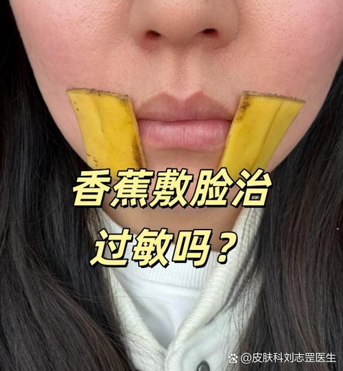 脸过敏治疗小妙招香蕉缩略图