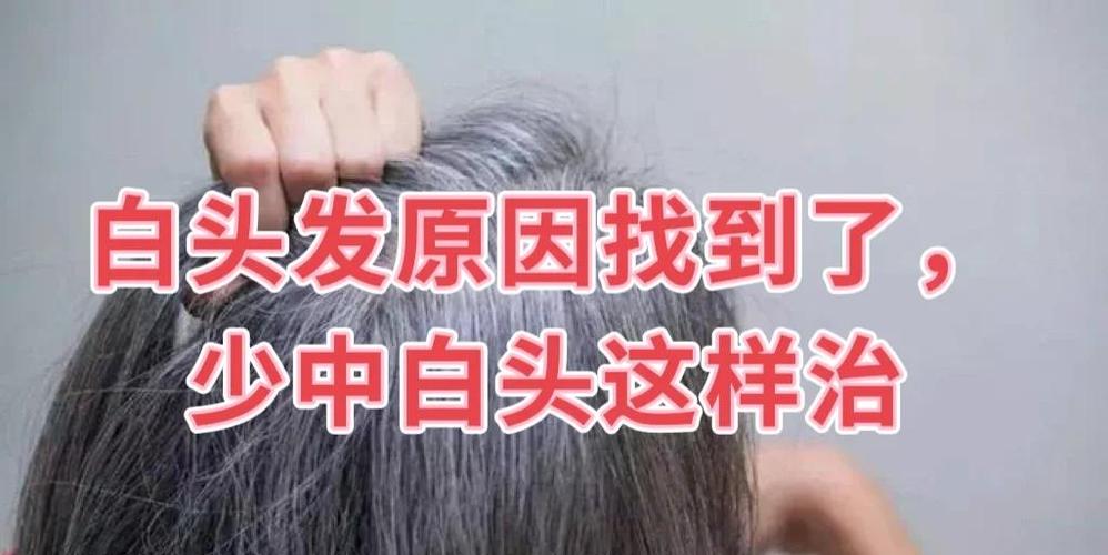 为什么头发白的快是什么原因截图