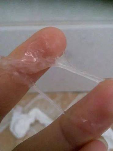 流出白色状分泌物是什么原因