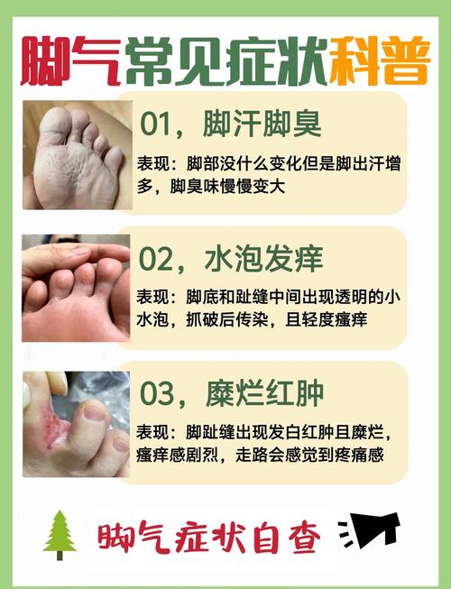 蜂窝状脚气怎么根治