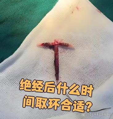 拿环什么时候最合适