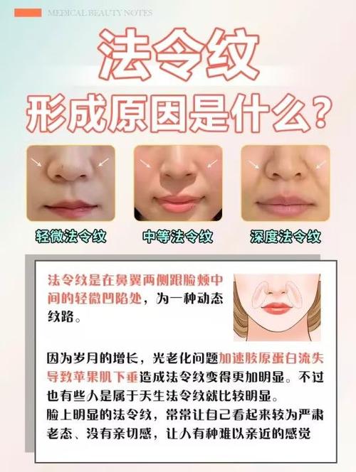 法令纹深用什么办法解决最好