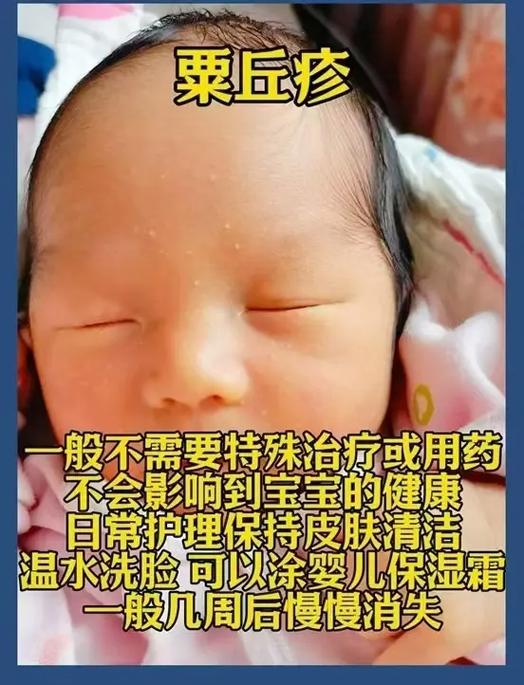 单机全皮肤软件