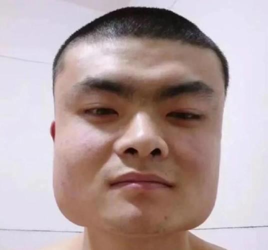 方脸和国字脸哪个更难看