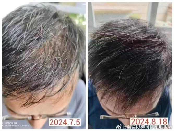 白色变黑了如何处理