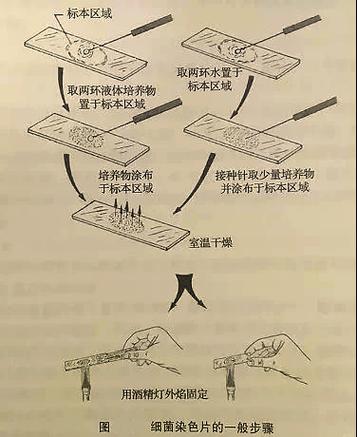 临时涂片和临时装片的区别