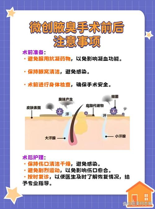 昆大腋臭医院属于正规医院吗