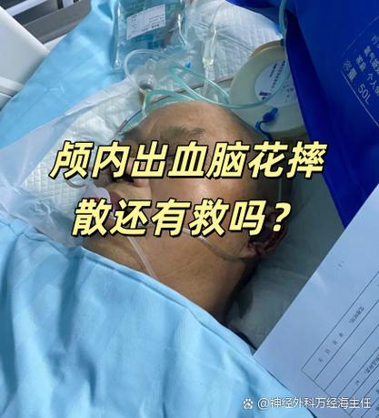 脑散了还有救吗