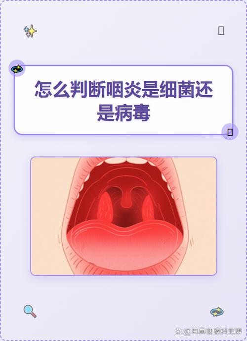 怎样判断咽炎是细菌还是病毒
