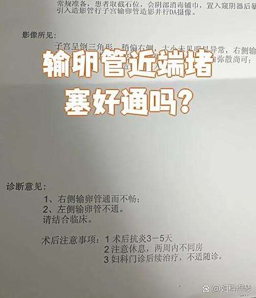 输卵管堵塞可以做试管婴儿吗