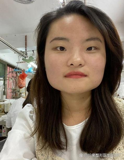 脸宽的人