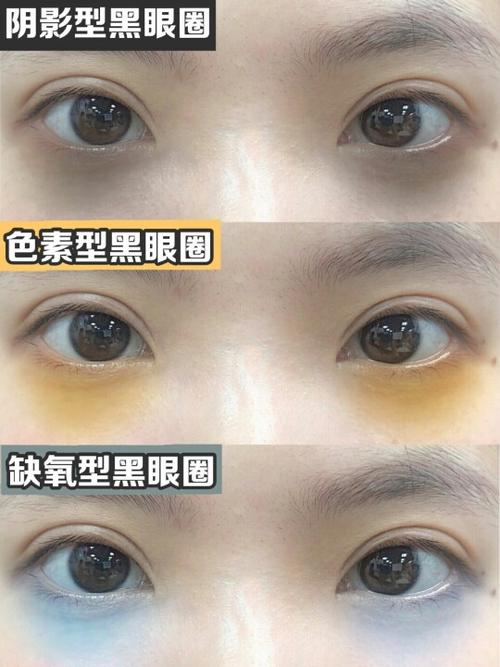 黑眼圈去除法