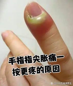 手指尖触摸手机屏幕痛游戏截图