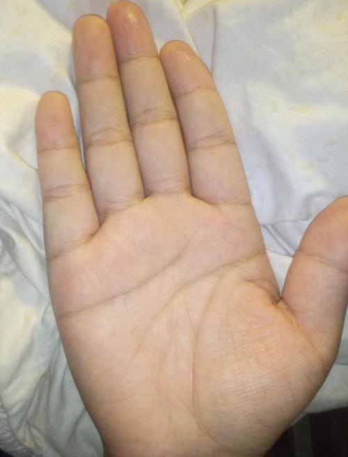 财运线出现了横纹干扰