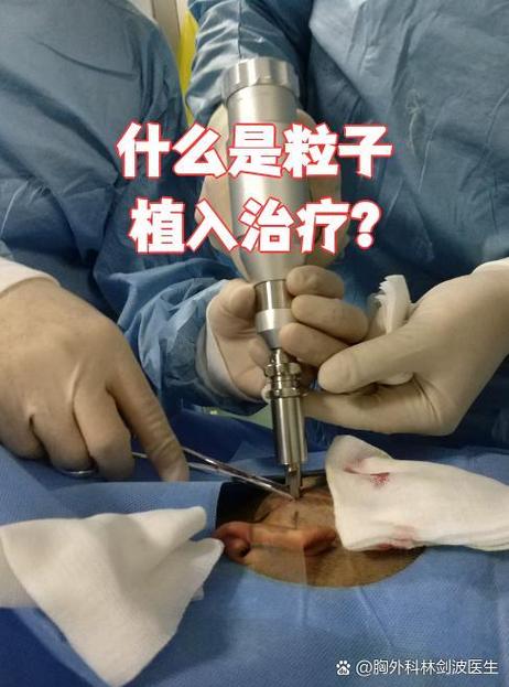 粒子植入治疗肿瘤的副作用