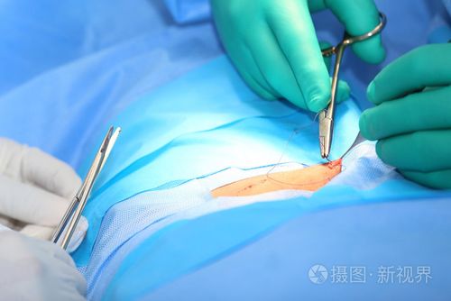 医生缝针手法视频