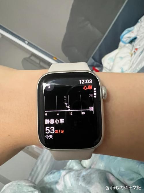 苹果手表心率设置截图