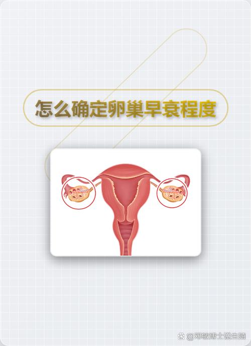 卵巢早衰的三个指标