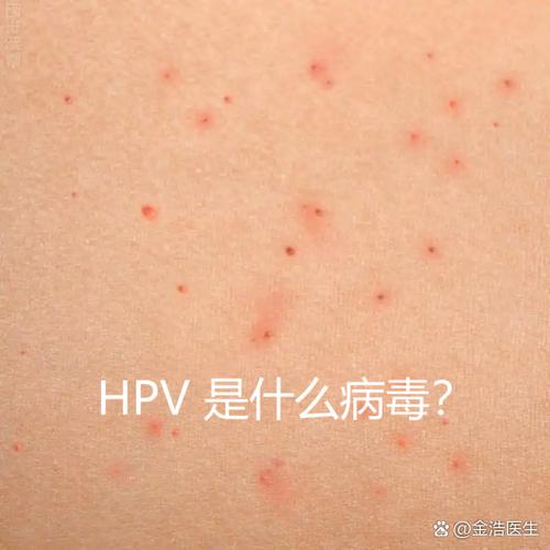 正常人有hpv病毒吗