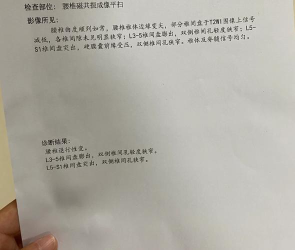 屁股下方抽筋一样的痛截图