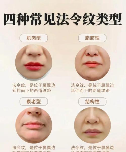 去法令纹的小窍门