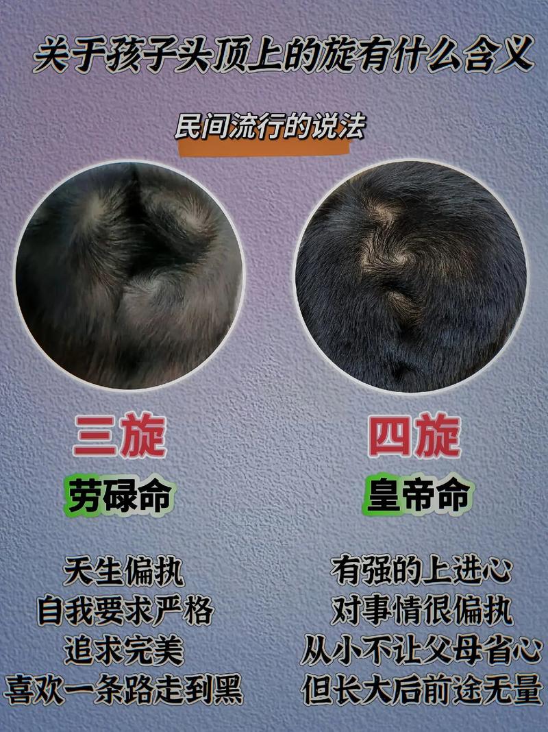 男孩头顶双旋民间说法