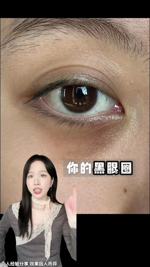 初中生一分钟去黑眼圈