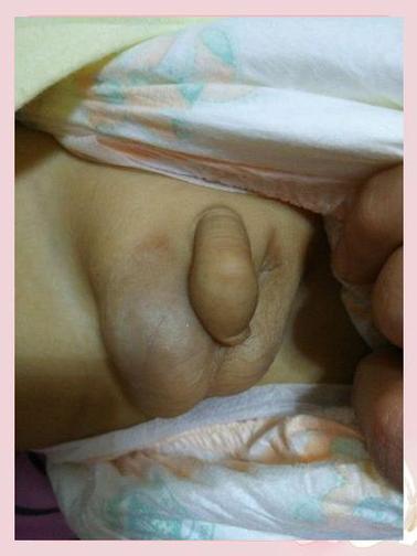蛋丸一个大一小是什么原因截图