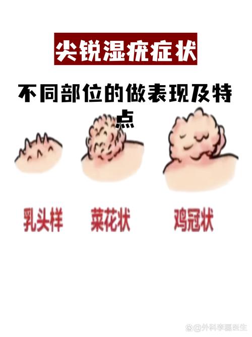 得菜花有什么症状