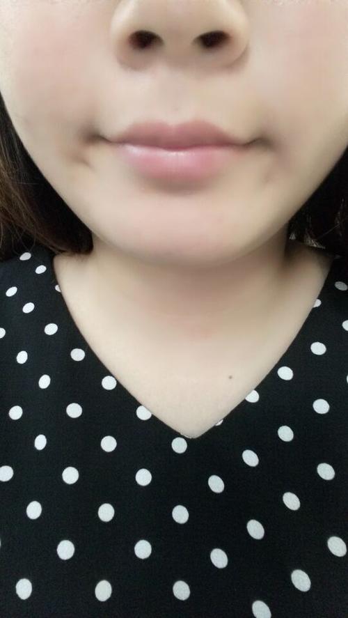 嘴巴下面的梨涡图片