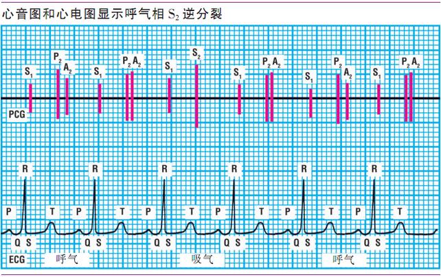 心音s1和s2的区别