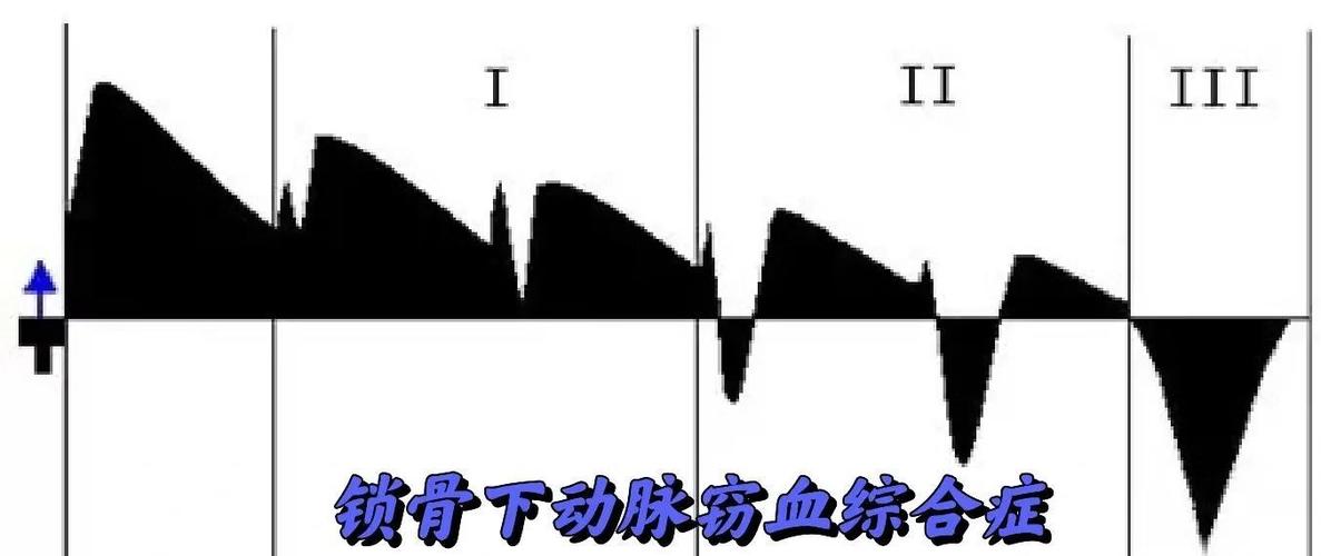 隐匿性盗血