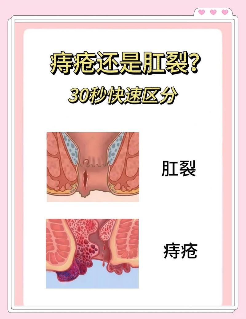 女性肛门被开过和没开过的区别