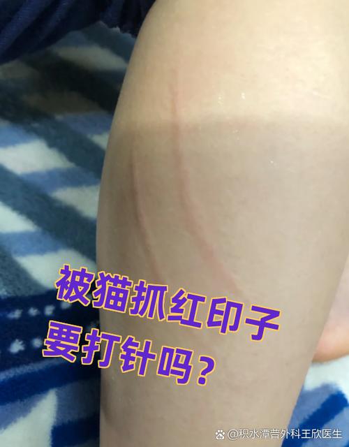 被猫抓后的红点图片
